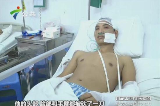 另一名傷者頭部、臉部和手臂都被砍了一刀。(視頻截圖)