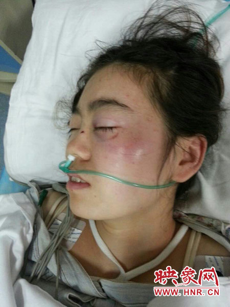 9月10日晚,被暴打的小陳出現(xiàn)了間歇性昏迷,被送進(jìn)了省人民醫(yī)院。