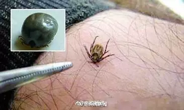 男子釣魚感覺(jué)手腕有小蟲(chóng) 拍死后瞬間雙手起皰潰爛