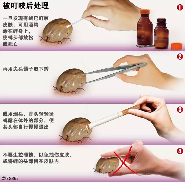 男子釣魚感覺(jué)手腕有小蟲(chóng) 拍死后瞬間雙手起皰潰爛